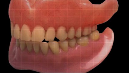 Denture Care Center in Salt Lake City