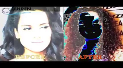 Bollywood Celebs Obsessed With Cosmetic Surgeries _ Latest Bollywood Gossip