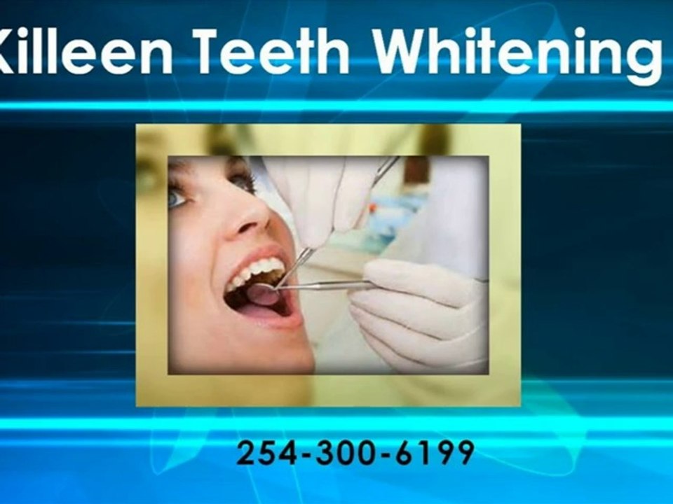 Main Reasons for Tooth Bleaching
