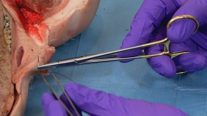 Tariq Drabu Explains the Process of Wound Closer And Soft Tissue Management