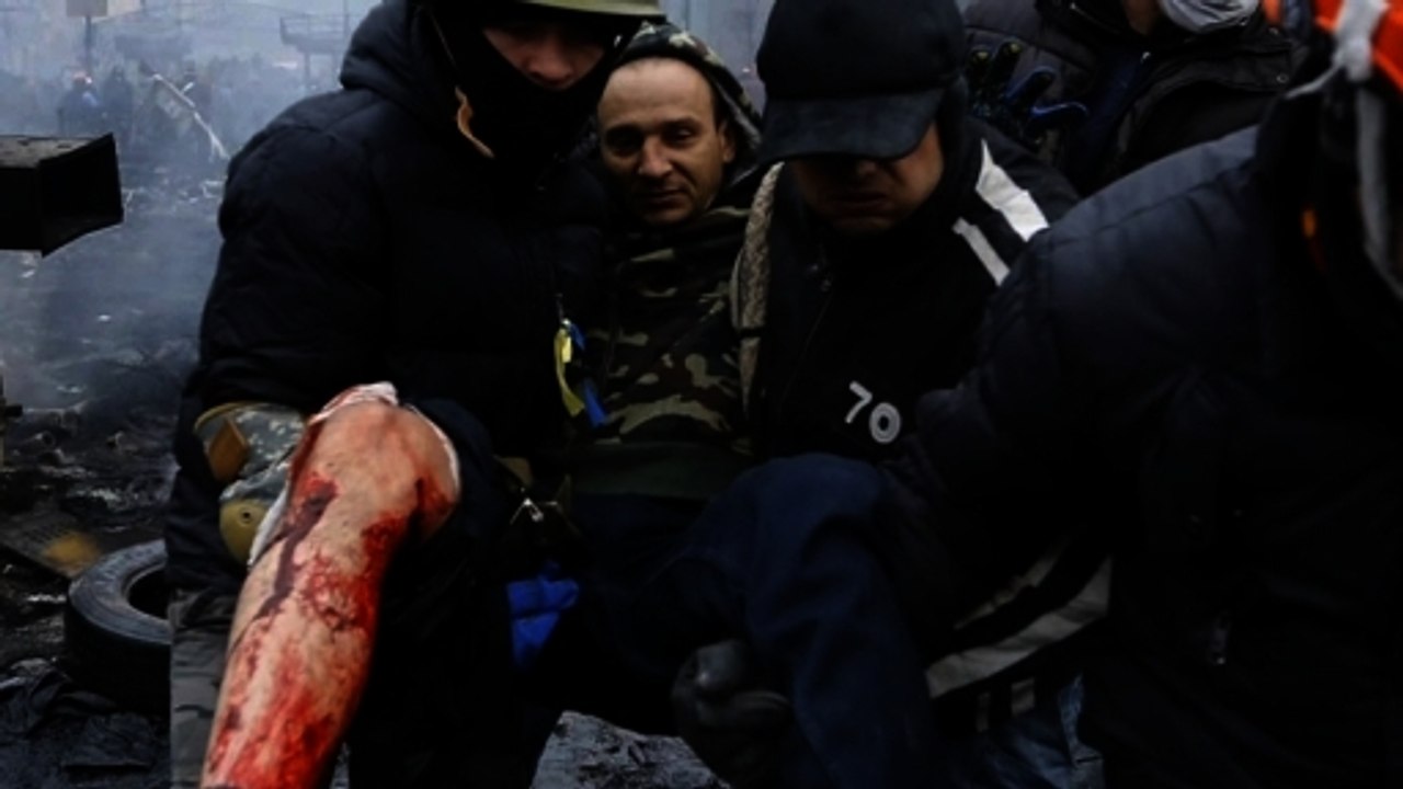 Injured arrive in Kiev hospitals as concern grows in US