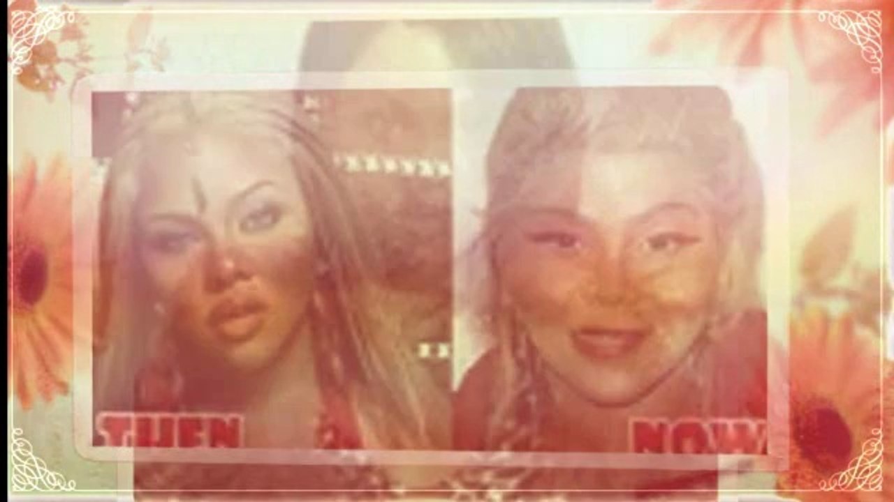 Lil Kim Plastic Surgery