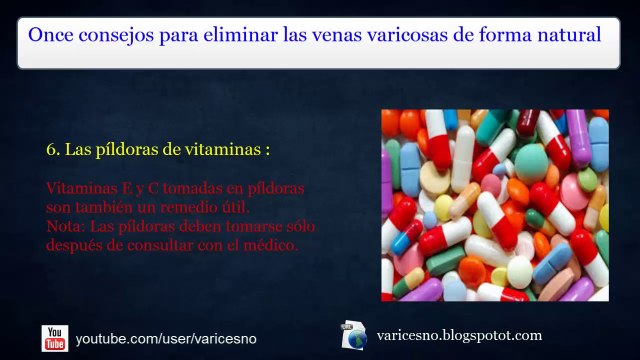 11 consejos para erradicar las venas varicosas de manera natural