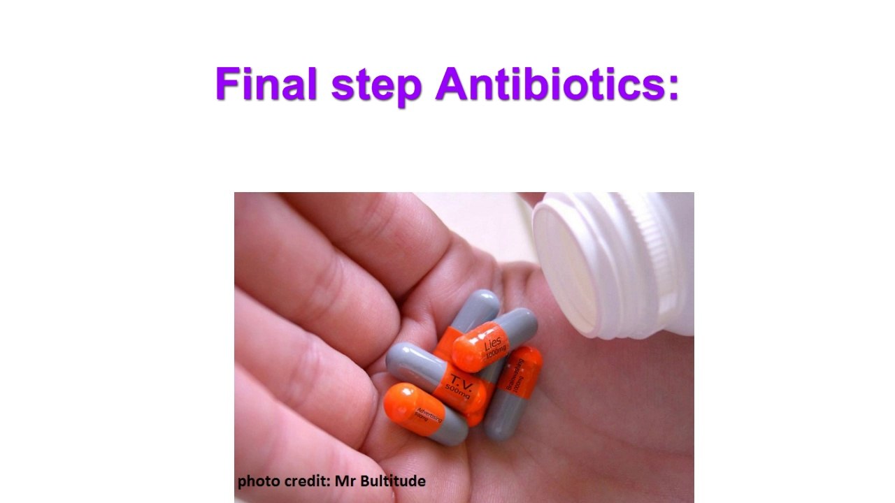 How To Remove Tonsillolith/Tonsil Stones At Home? With Pictures - UD Visions