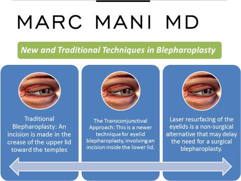 Marc Mani, MD Breast Augmentation Beverly Hills