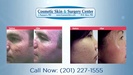 Acne Treatment NJ - Dr. Jeffrey Rapaport