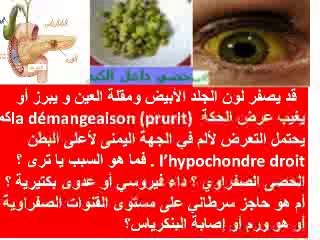 Cholestase-Dr AMINE Abdelkader -Casablanca