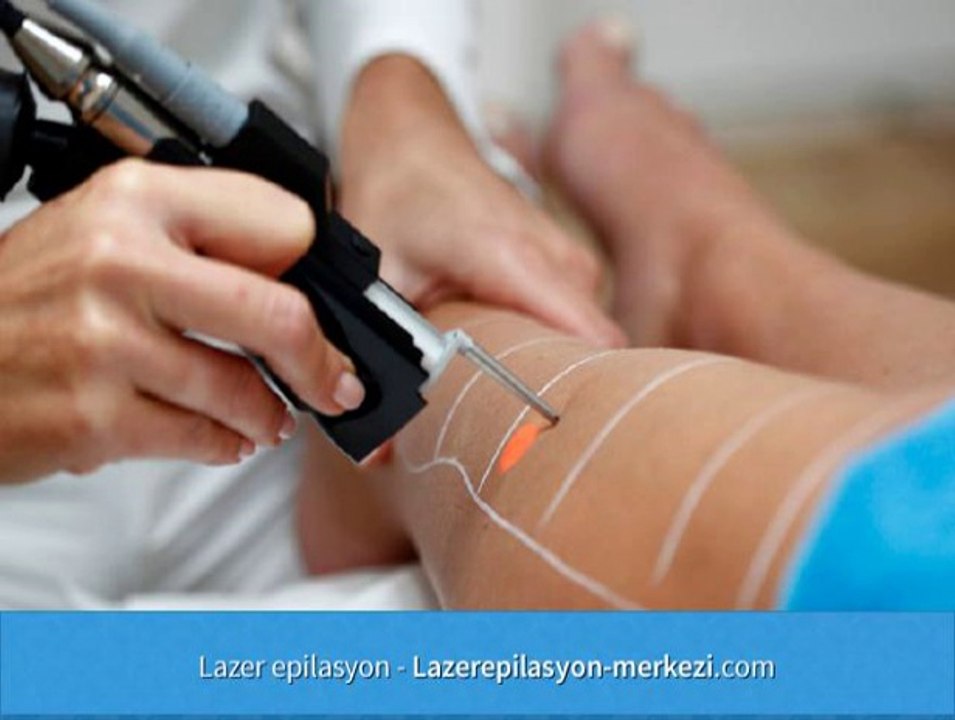 Lazer Epilasyon Adana