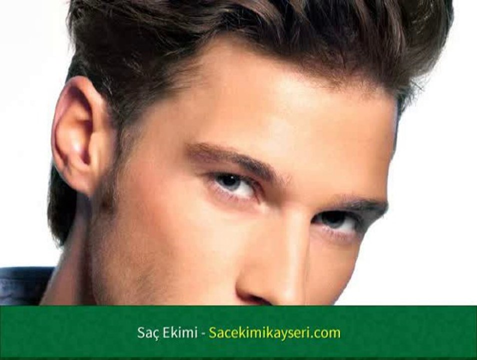 Saç Ekimi Wiki