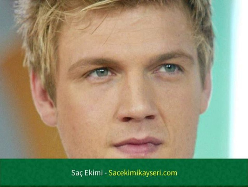 Saç Ekimi Merkezleri İstanbul