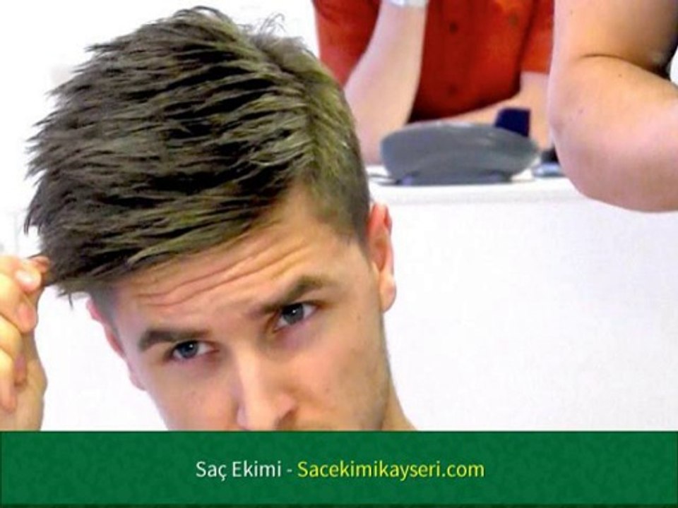 Saç Ekimi Van