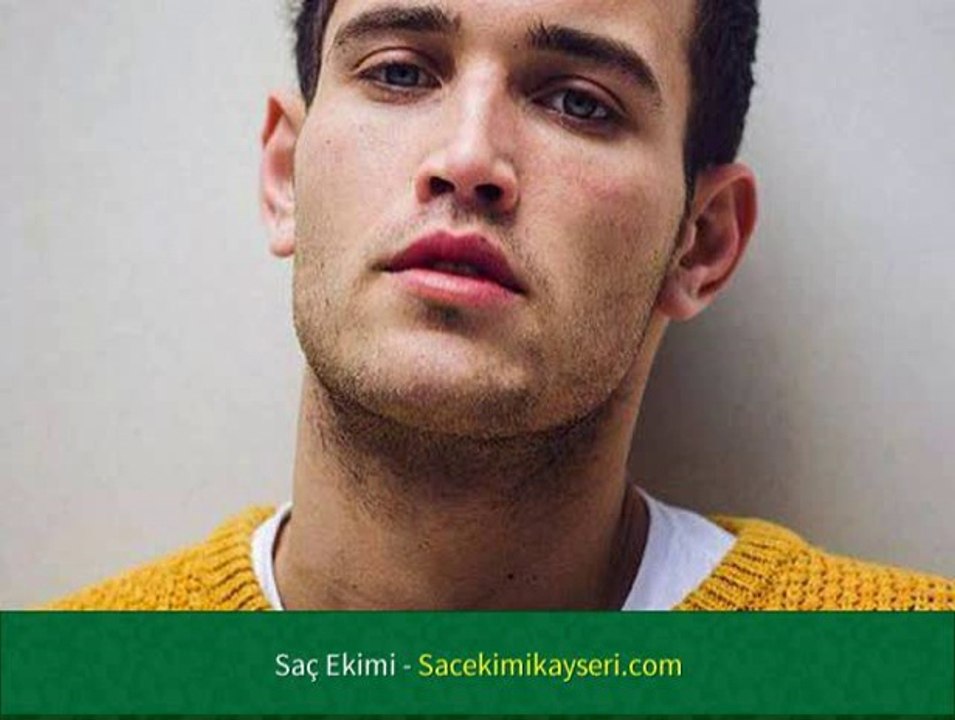 Saç Ekimi Yöntemleri