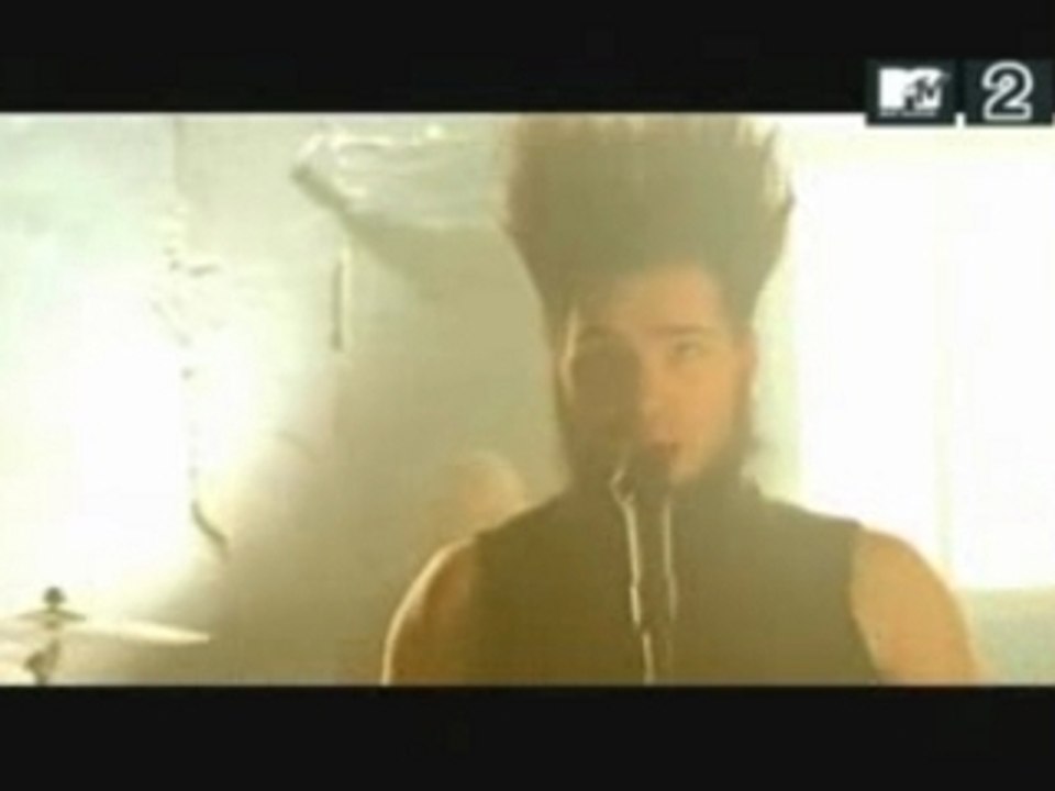 static_x-so