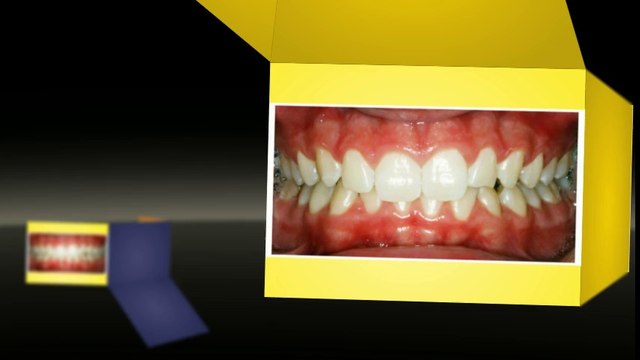 Orthodontists Dallas Jan2014