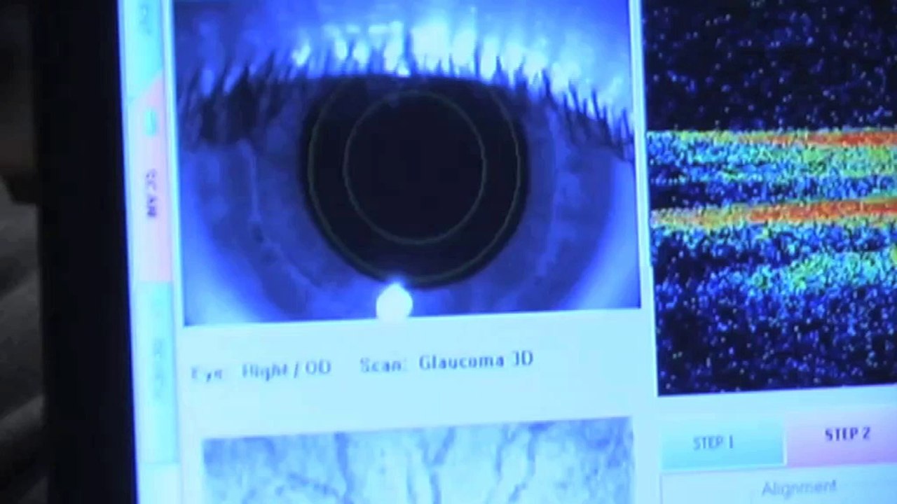 optikere - Sønderborg Bleshøy Optik