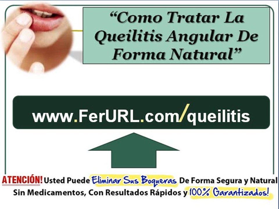 Como tratar la queilitis angular - Como eliminar las boqueras naturalmente