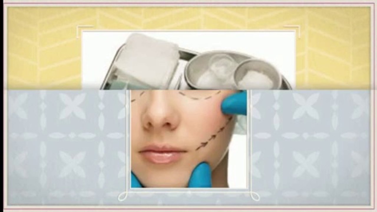 Anna Faris Plastic Surgery