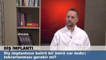 Diş implantının belirli bir ömrü var mıdır tekrarlanması gerekir mi?