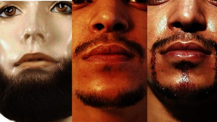 Patchy On The Facial Hair Front? Time For A Beard Transplant