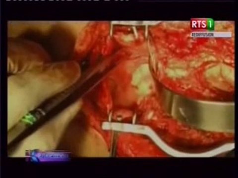 Infos matinales du jeudi 27 février 2014 (RTS1)