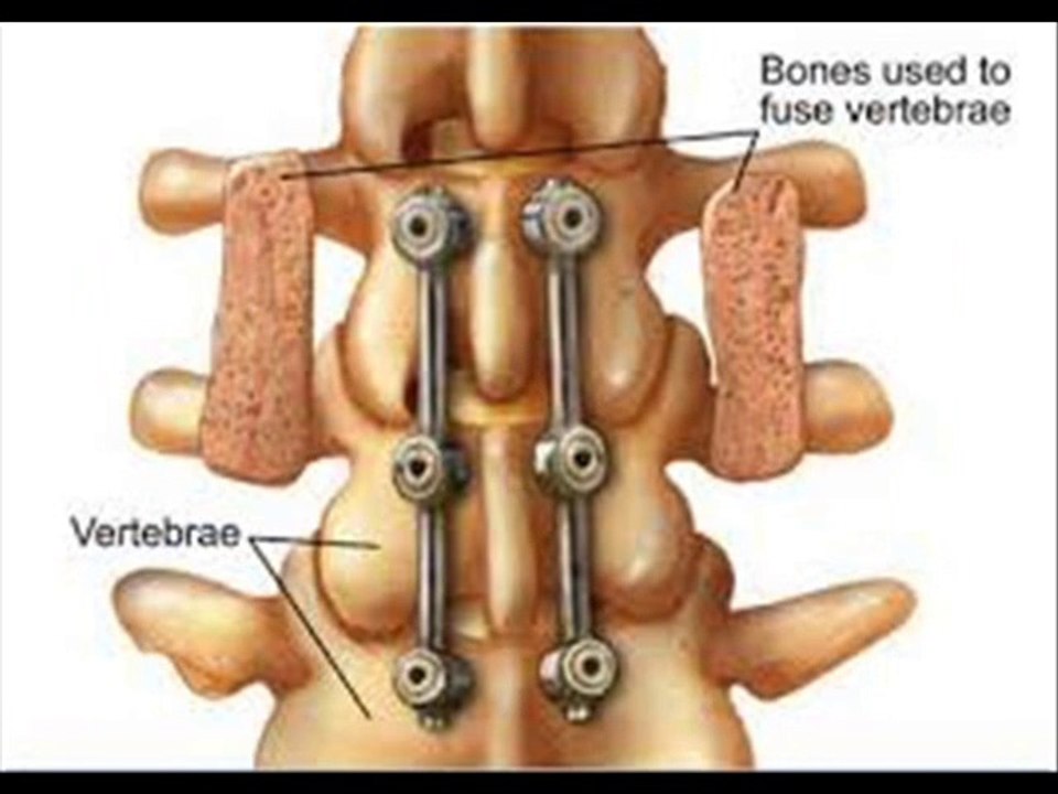 Palm Beach Brain & Spine LLC