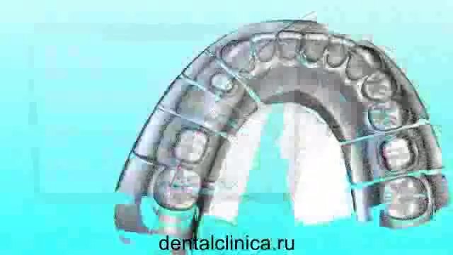 European Clinic Dentistry Моделирование CAD CAM лечение зубов протезирование SIM