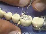 Hi-Tech Dental Lab Стоматология протезирование, красивые улыбки счастливые лица
