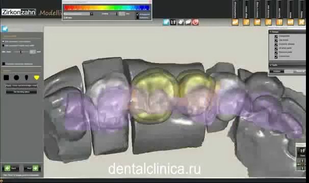 Клиника эстетической стоматологии, моделирование CAD CAM, имплантация протезирование