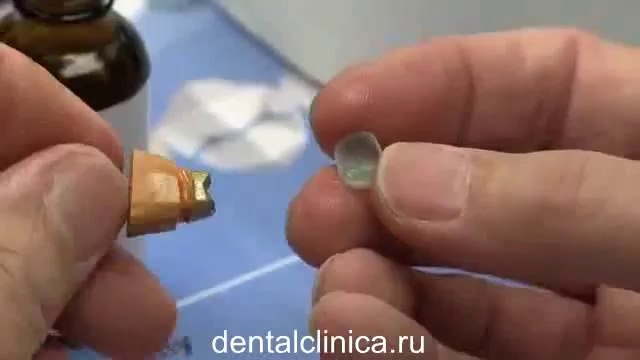 Клиника эстетической стоматологии, новые технологии, коронки металлокерамика