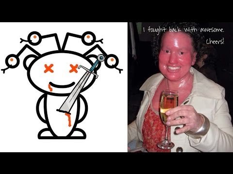 Skin condition girl fights back against Internet bullies, wins!