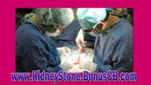 kidney stone remedy - male kidney stone removal - kidney sto - Vìdeo Dailymotion