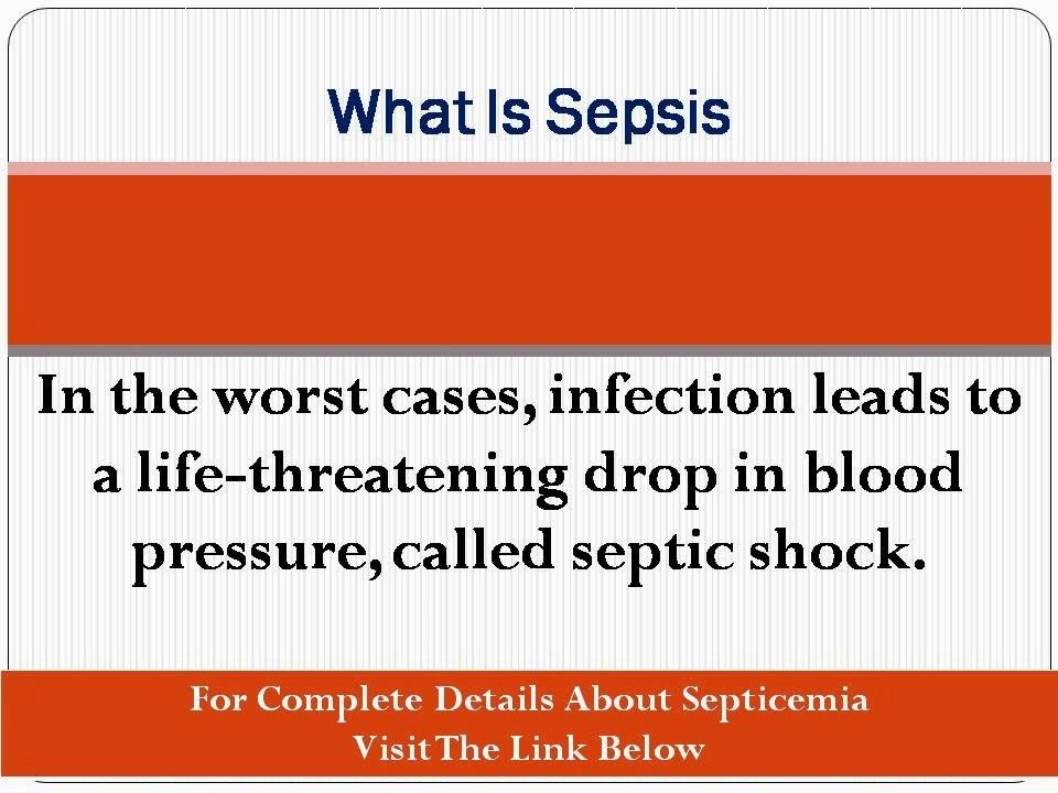 What Is Sepsis, Sepsis Symptoms And Sepsis Treatment