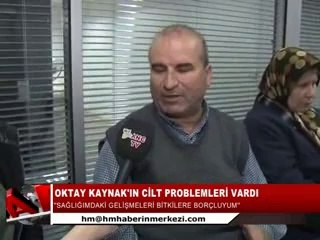 22-OKTAY KAYNAK- CİLT PROBLEMİ