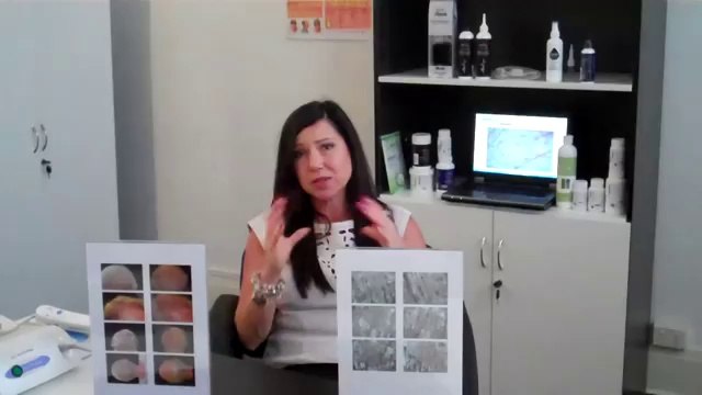 Hair Loss Treatments By Absolique Hair Health Clinic