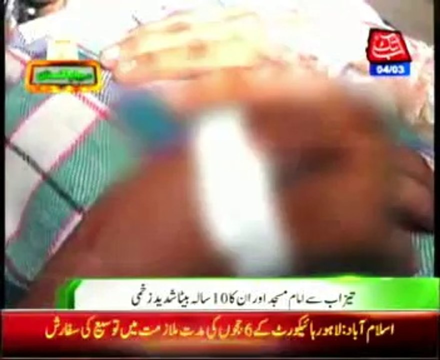 Okara unidentified persons acid attack on Imam e Masjid