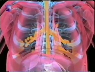 Muerte por vomito: Perversion letal