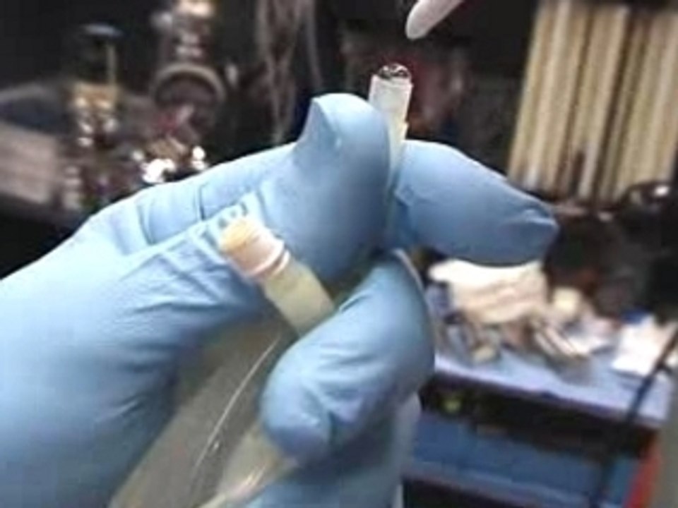 Air Emboli