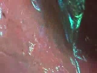 BOARDS OF CANADA - AQUARIUS+KID 4 TODAY