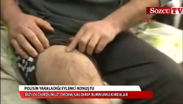 3130 Kask numaralı polisin yaraladığı eylemci konuştu