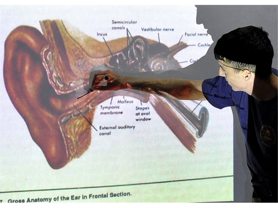 Ringing in the Ears (Tinnitus)-Topic Overview