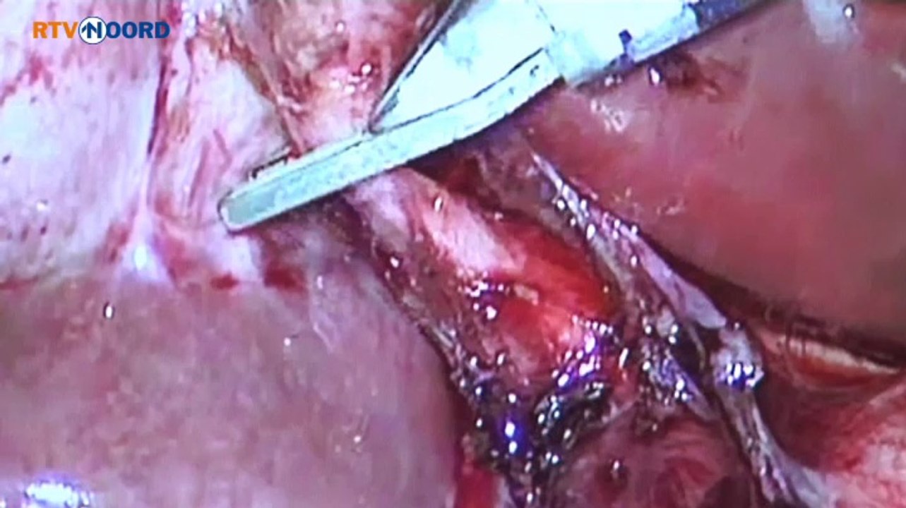 Ziekenhuis toont hoe het er binnen aan toegaat - RTV Noord