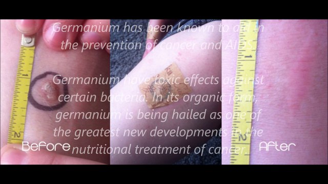 FG Xpress Facts an Benefits Power Strips Pain Patch Energy and Pain Relief. Benefits/facts