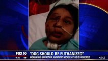 Support Floods in for Dog That Mauled Boy