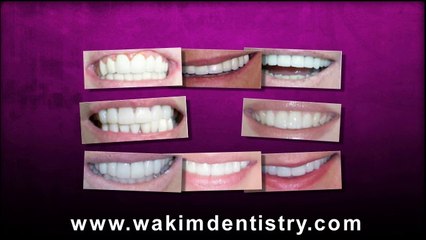 Cosmetic Dentisty by Antoine Wakim, D.D.S