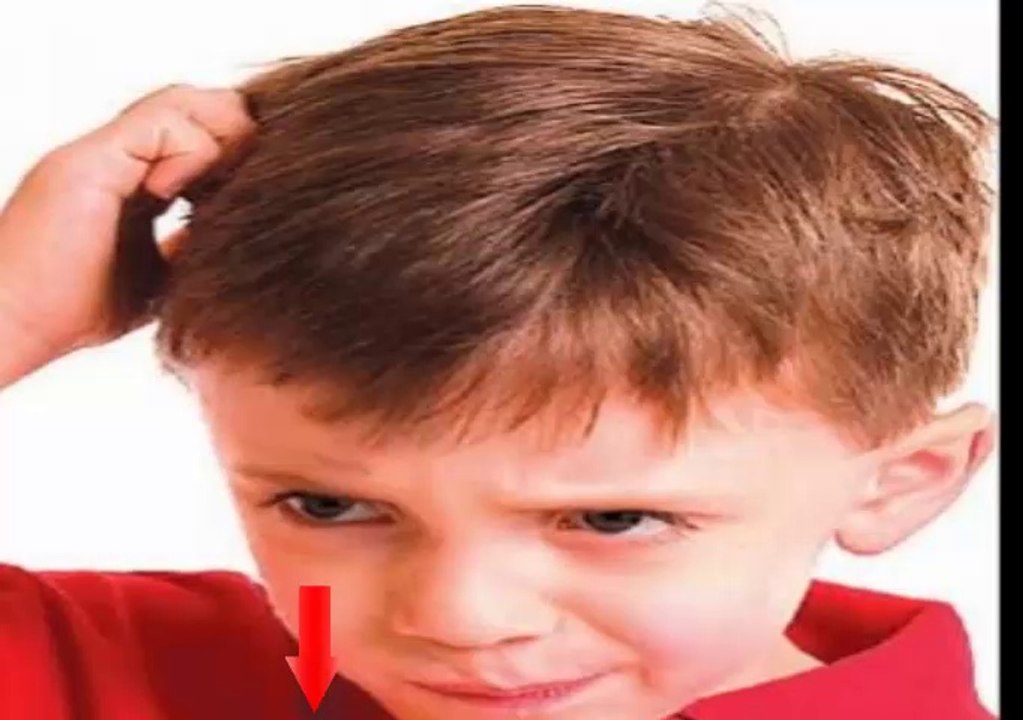 SOLUCIÓN CONTRA LOS PIOJOS