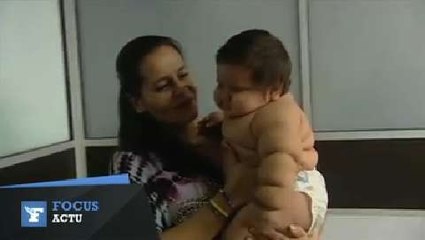 En Colombie, un bébé de 8 mois dépasse les 20 kilos