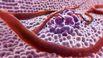 What Is Cancer? 3D Animation Explanation