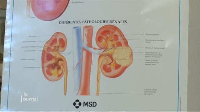 Santé : Une semaine pour prévenir les maladies rénales