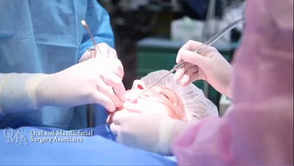 Jaw Surgery - Montgomery, Prattville, Troy - Orthognathic Surgery