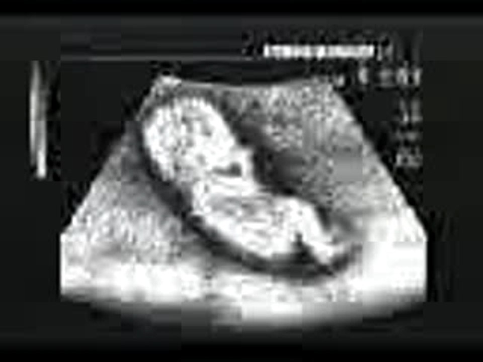 Baby